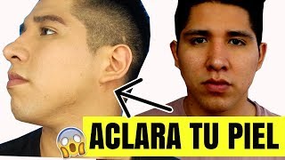 BLANQUEA TU PIEL EN 7 MINUTOS CON ESTE SECRETO Natural  ¡MIRA COMO ACLARE MI PIEL EN VIVO 😱😱 [upl. by Fritzie]