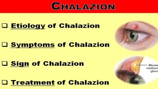 Chalazion [upl. by Eitac]