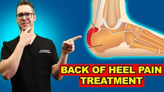 Retrocalcaneal Heel Bursitis Pain in the back of the Heel TREATMENT [upl. by Hinze701]