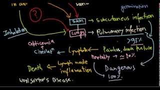 Bacillus anthracis infection [upl. by Artemas]