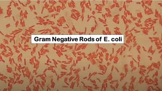 E coli in Gram staining [upl. by Doniv]