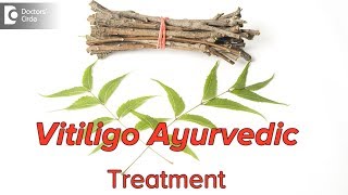 How can we treat vitiligowhite patchesthrough Ayurveda  Dr Mini Nair [upl. by Celesta410]