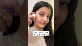 Best ANTIACNE Serum In India  Salicylic Acid  Niacinamide [upl. by Thynne]