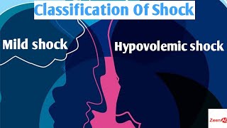 Classification Of ShockHypovolemic Shock And Its ManagementMild ShockModerate ShockSevere Shock [upl. by Marlo]