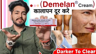 Demelan Cream Review  How to Use Demelan Cream  Sahil Nagpal [upl. by Etnoid]