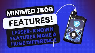 Lesser Known features of the Medtronic MiniMed 780G System [upl. by Tullusus]