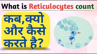 What is Retic count  Reticulocyte count Test [upl. by Nyleuqcaj]