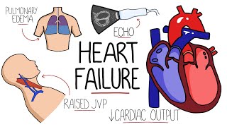 Heart Failure Explained  HFrEF vs HFpEF Systolic vs Diastolic Heart Failure [upl. by Aroved]