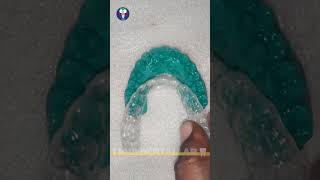 Toothsi  Dentist Lab World  Orthodontics Teeth Treatment  Painless  Tamil Dental Lab🦷dentallab [upl. by Issy]