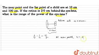 The near point and the far point of a child are at 10 cm and 100 cm If the retina is 20 [upl. by Nylicaj]