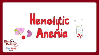 HEMOLYTIC ANEMIA Extravascular v Intravascular Clinical Features Diagnosis Coombs Test  Rhesus [upl. by Ahsiliw]