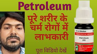 Petroleum  Symptoms and uses in hindi Dr Anmol kr [upl. by Sacram398]