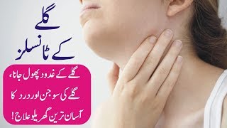 Tonsils ka gharelu ilaj  Tonsillitis treatment in urdu  Galay ke tonsils ka ilaj [upl. by Ydnerb]