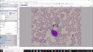 Conducting a Differential WBC Count with Human Blood [upl. by Akirdnuhs]