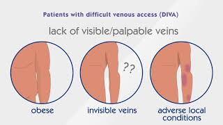 What is a Midline and what are the indications [upl. by Naimed]