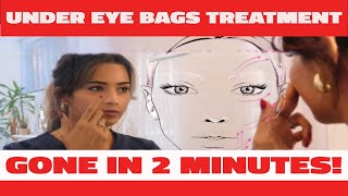 I tried quotThisquot Under Eye Bags Treatment That Works in 2 Minutes [upl. by Grosmark]