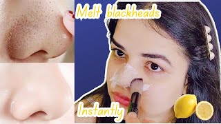 DIY Blackhead Peel Off Mask with an Egg  It Actually WORKS 😲✨ Blackheads Removal on face [upl. by Sandor387]