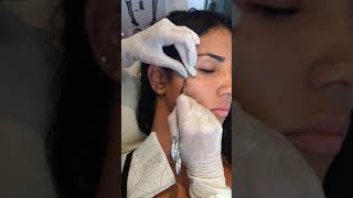 Colocando um piercing Microdermal no rosto [upl. by Hniht]