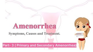 Amenorrhea part 3 primary Amenorrhea  secondary amenorrhea [upl. by Teeniv]