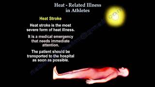 Heat illness heat stroke [upl. by Barabas]