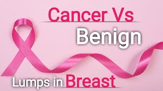 Benign Vs Malignant Breast Lesions on Ultrasound Cancer Vs Non cancerous lumps of breast Breast [upl. by Meehan]