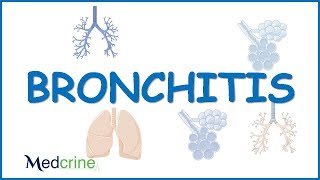 Acute Bronchitis  causesclinical featuresdiagnosis and treatment [upl. by Perkins]