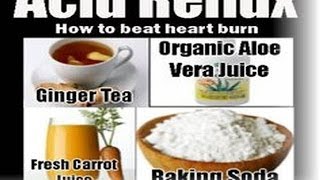 How to Cure Acid Reflux Fast Naturally  Treat Acidity GRED Permanently [upl. by Ahsennod]