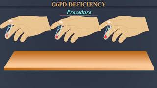 G6PD Deficiency [upl. by Dranel]