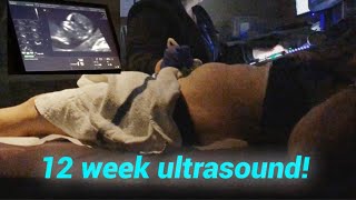 12 WEEK ULTRASOUND [upl. by Oer]