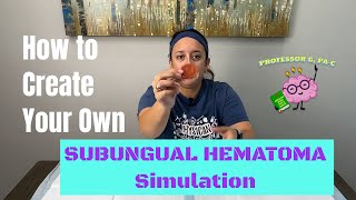 How to Make a Subungual Hematoma Simulation at Home [upl. by Nirre130]