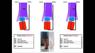 The Subtalar Joint Part 2  Pronation vs Supination EXPLAINED [upl. by Arnaud]