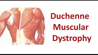 Duchenne Muscular Dystrophy [upl. by Adelia645]