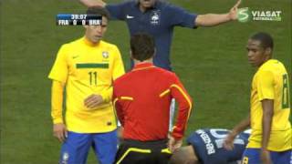 France Vs Brazil  Hernandez kicks Benzema Full Goals amp Highlights FRIENDLY 2011 February [upl. by Kosiur]