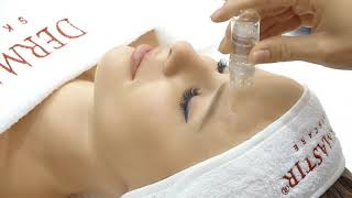 Dermastir Microneedling StampOn [upl. by Jenette]