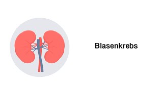 Blasenkrebs Blasenkarzinom  Erkrankungen der Niere und ableitenden Harnwegen [upl. by Seftton]