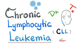 Chronic Lymphocytic Leukemia CLL  Diagnosis and Treatment Hematology and Oncology Series [upl. by Harriett]