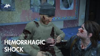 Hemorrhagic Shock in Traumatic Injuries  The Last of Us [upl. by Isiah]