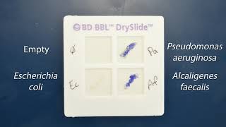 Demo Biochemical Tests  Oxidase Test [upl. by Dihahs92]