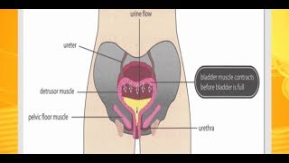 Overactive Bladder Causes Symptoms and Medication Usapang Pangkalusugan [upl. by Lazos239]