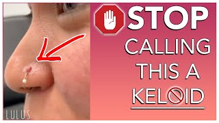 STOP CALLING BUMPS ON YOUR PIERCING KELOIDS [upl. by Eniotna180]