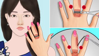 ASMR Remove tight ring from maggots infected swollen finger  Danger parasite extracting animation [upl. by Connel]