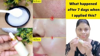 I used Vitamin C Serum 7 days👆🏻This is what happened Tight glowing fair skin for uneven Dull skin [upl. by Werd]