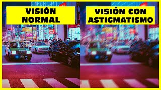 👁 ¿Qué es el ASTIGMATISMO 👉 3 SÍNTOMAS típicos de astigmatismo 👈 [upl. by Kcirad]