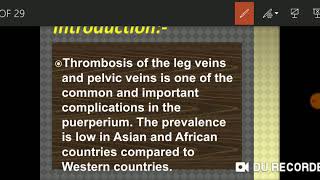 Puerperal venous thrombosis [upl. by Drida]