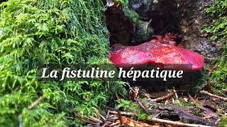 La fistuline hépatique [upl. by Anatol]