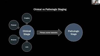 24part 1lung Cancer TNM staging by DrRishi Agrawal [upl. by Finnigan]