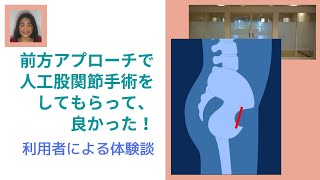 前方アプローチで人工股関節手術をして頂いて良かった！ [upl. by Alamaj]