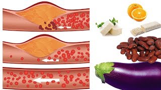 9 Makanan Penurun Kolesterol LDL Tinggi dengan Cepat [upl. by Paulina]