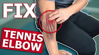 Ultimate Guide Effective Techniques to Fix Tennis Elbow Fast  Physical Therapist  Tustin Irvine [upl. by Landau]