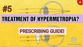 5 TREATMENT OF HYPERMETROPIA  Principles of hypermetropic correction  AAO guidelines [upl. by Hurwit517]